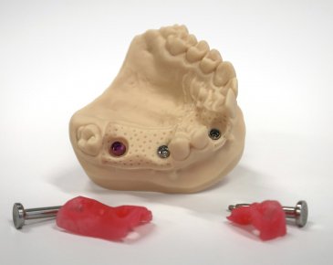 Dental models